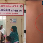 stray-dog-attack-surendranagar-krishnanagar-civil-hospital