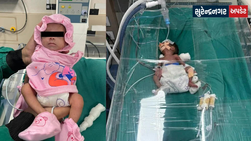 560-gram-premature-baby-survives in shrimad rajchandra hospital surendranagar
